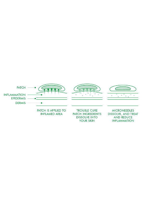 Acropass Trouble Cure Patch Diagram skincare-kbeauty-glowtime-Acropass Trouble Cure Patch