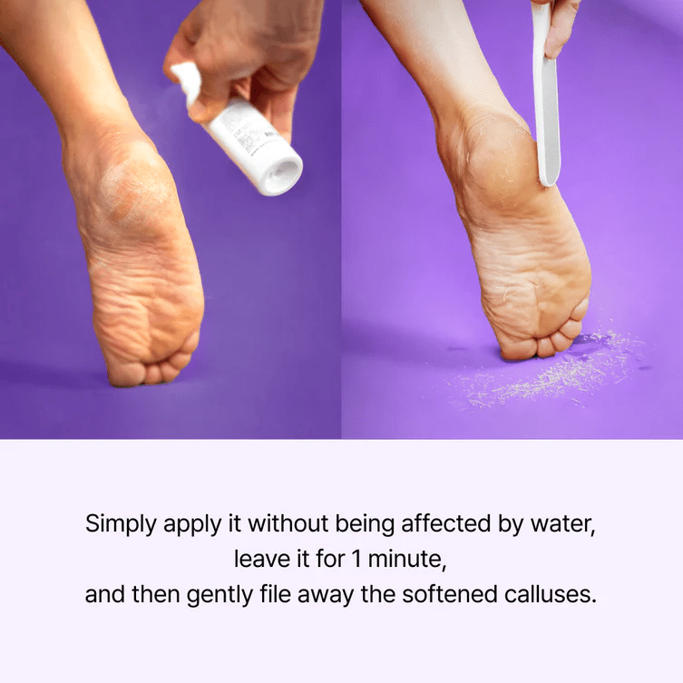 BAREN Callus Remover Foot Spray 5 skincare-kbeauty-glowtime-baren callus remover foot spray