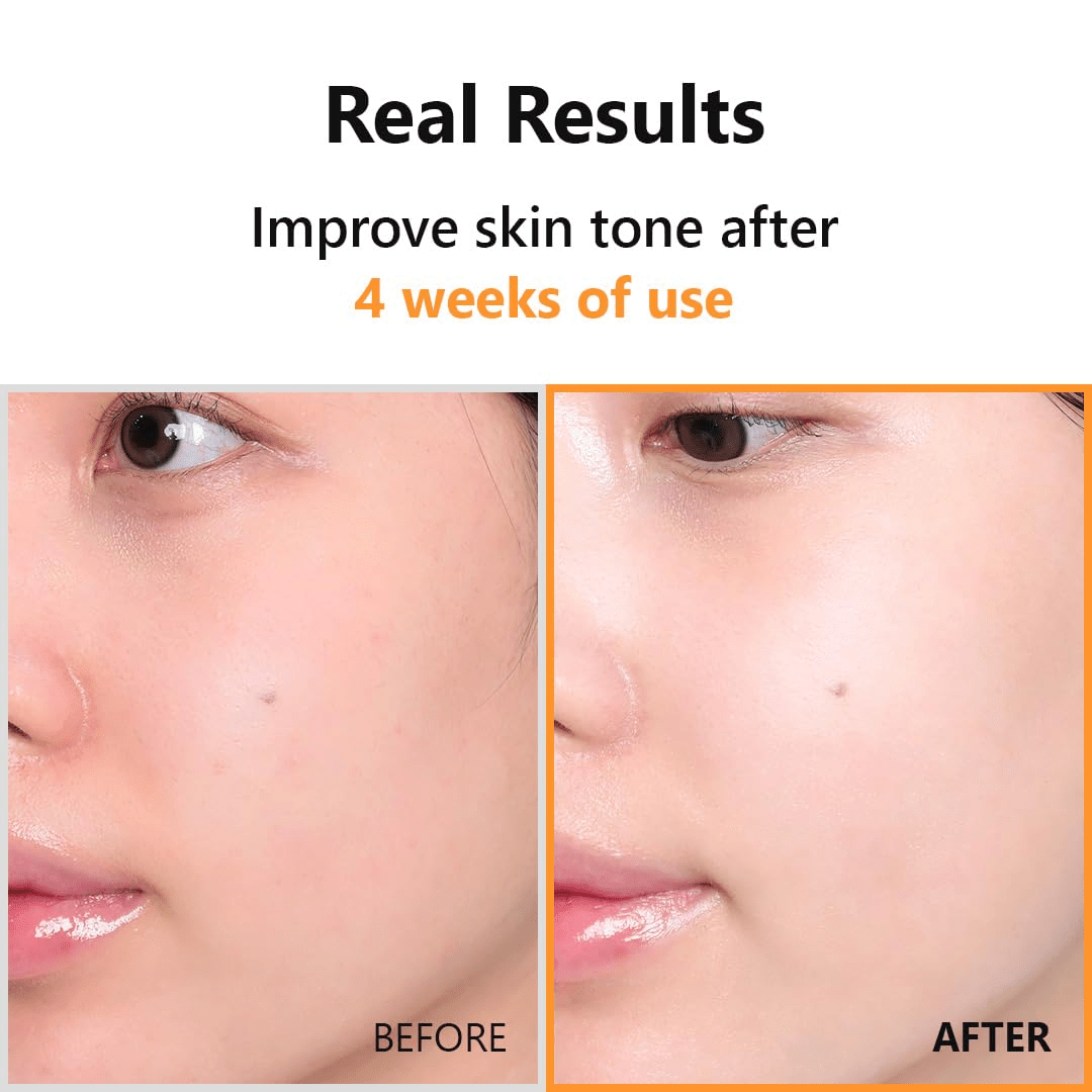 ISNTREE Hyuper Vitamin C 23 Serum 4 skincare-kbeauty-glowtime-isntree hyper vitamin C 23 seru