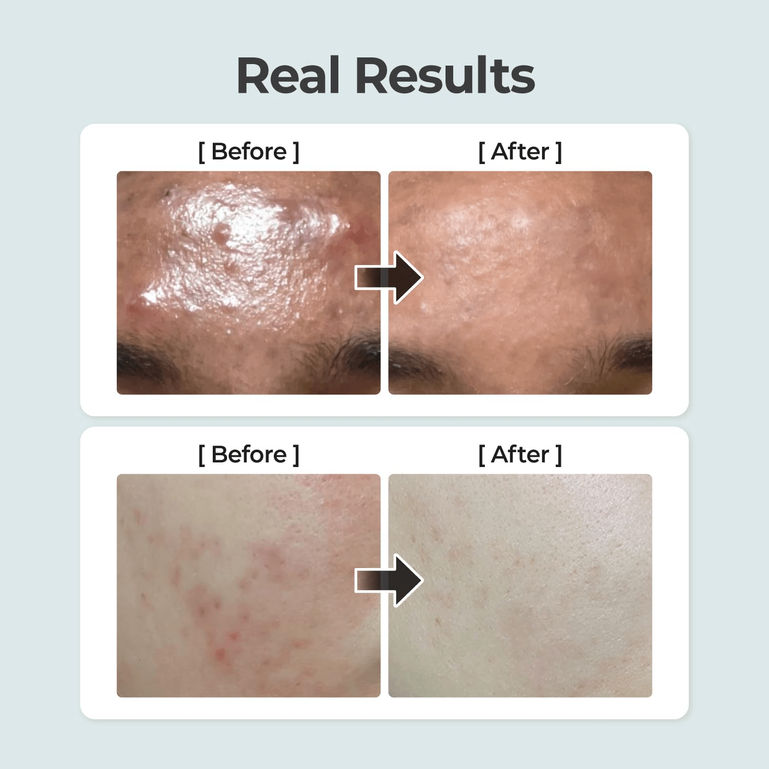 NUMBUZIN No 1 Pure-full Calming Herb Toner 3 skincare-kbeauty-glowtime-numbuzin no 1 pure full calming herb toner