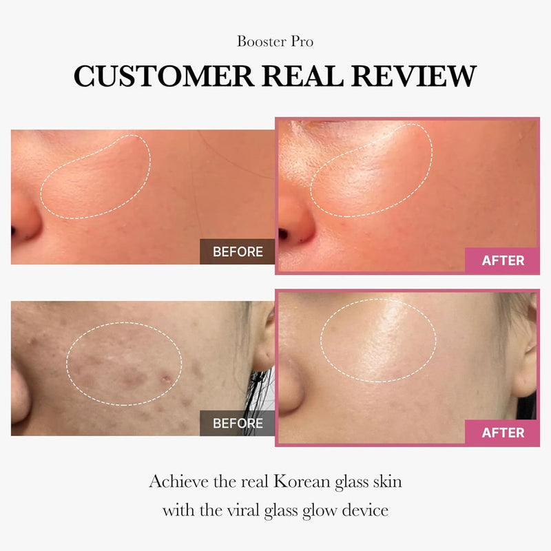 MEDICUBE Age R booster Pro Mini Pink 5 skincare-kbeauty-glowtime-medicube age r booster pro mini pink