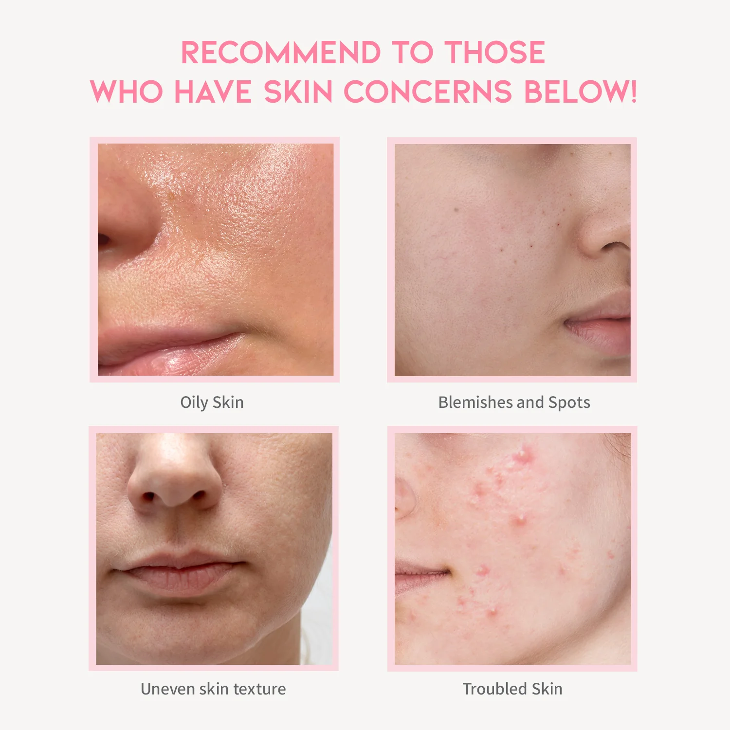 OOTD BEAUTY Clarifying Niacinamide Serum 3 skincare-kbeauty-glowtime-OOTD Beauty Clarifying Niacinamide Serum