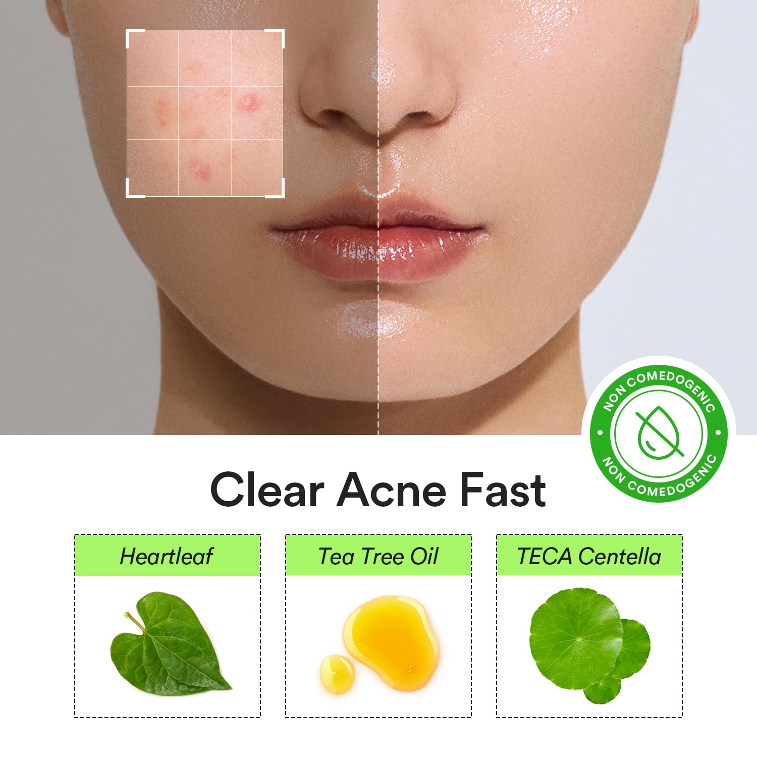 ABIB Heartleaf Calming Spot Patch 4 skincare-kbeauty-glowtime-abib heartleaf calming spot patch