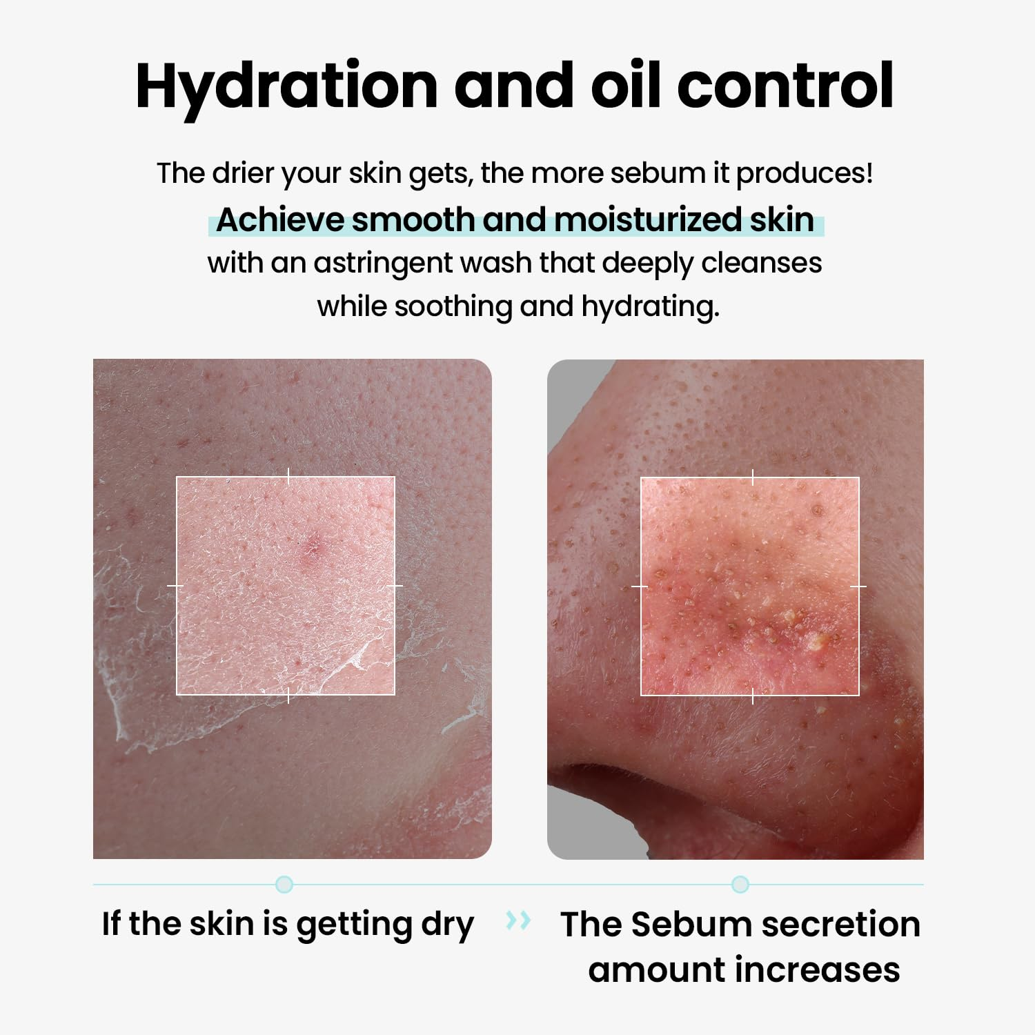 ILSO Melting Sebum Cleansing Oil 4 skincare-kbeauty-glowtime-ilso melting sebum cleansing oil