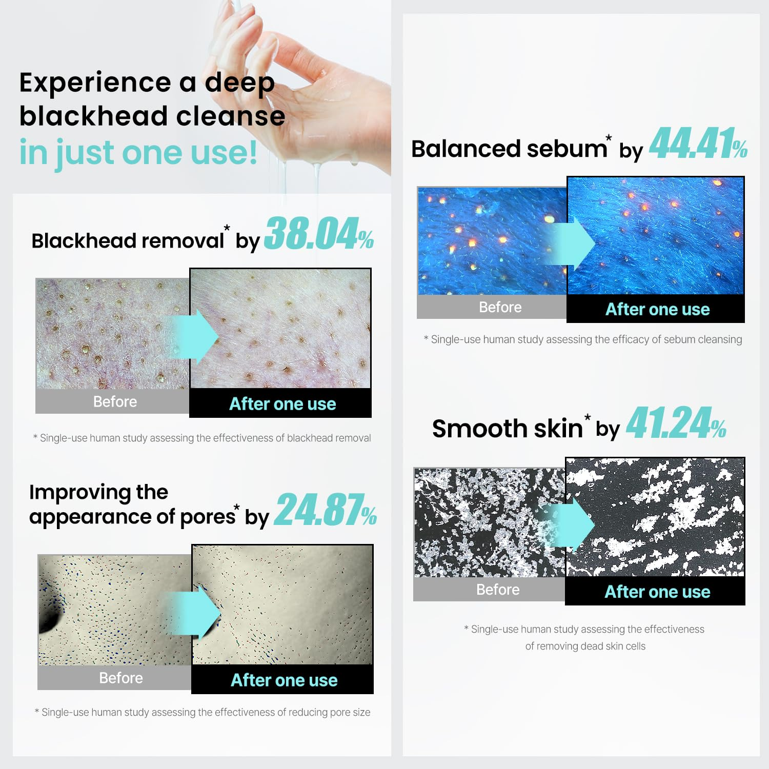 ILSO Melting Sebum Cleansing Oil 5 skincare-kbeauty-glowtime-ilso melting sebum cleansing oil