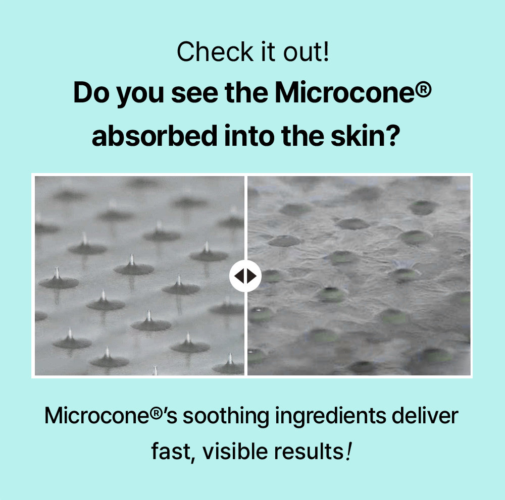 ACROPASS Pore Care Microcone Patch 2 skincare-kbeauty-glowtime-acropass pore care microcone patch