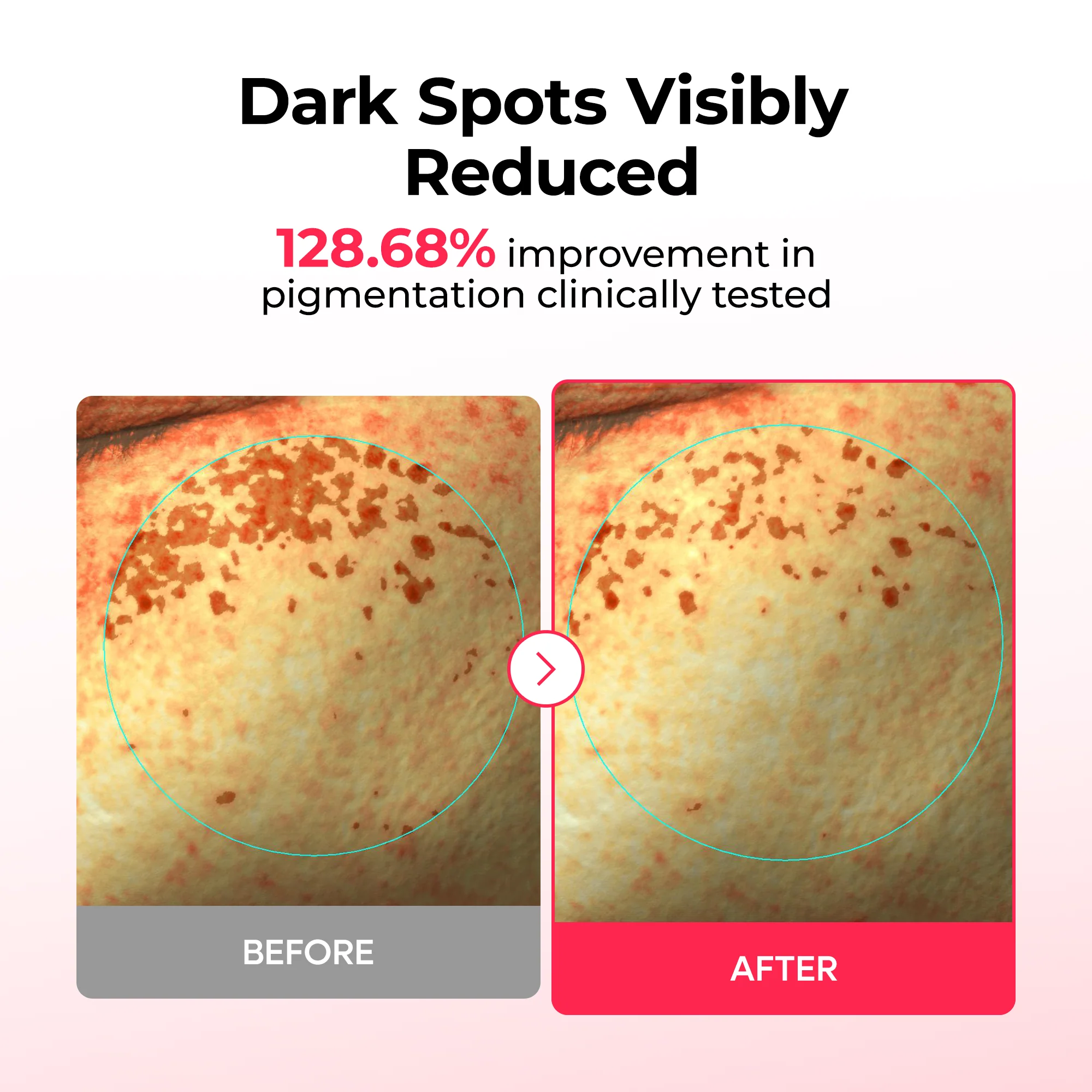DR MELAXIN TX Tranxamic Asthaxanthin Dark spot care mask 3 skincare-kbeauty-glowtime-dr melaxin tx tranexamic asthaxanthin dark spot care mask